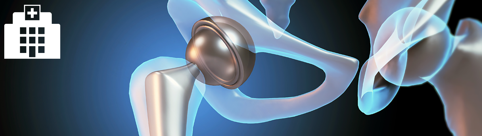 3D medical illustration of a hip joint replacement, showing a metallic artificial joint within translucent representations of pelvic and femur bones on a blue-black gradient background, with a white hospital icon in the corner.